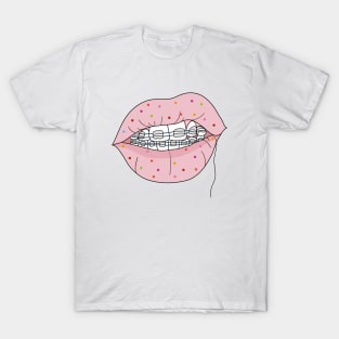 Braceface T-Shirt